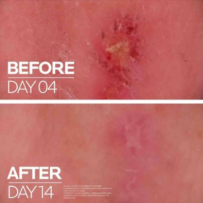 Cicaplast Baume B5+ 40 Ml | Cuidado corporal
