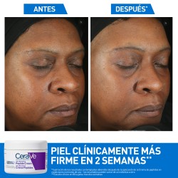CeraVe Skin Renewing Crema con Péptidos 48 ml – hidratación antiedad con ceramidas