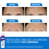 CeraVe Skin Renewing Sérum con Retinol 30 ml – mejora de la textura y renovación de la piel